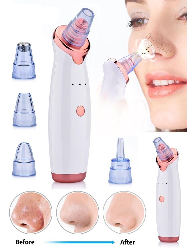 Vacuum Acne FOR Remove Pimple Skin - EZdeels