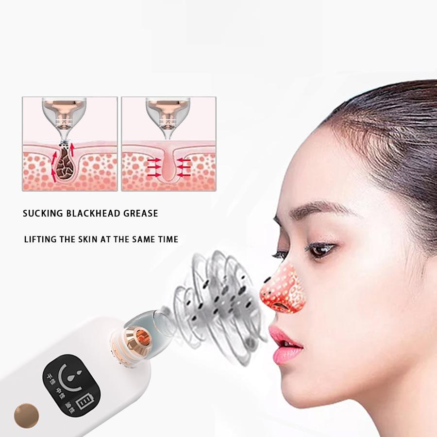 Blackhead Remover Vacuum Cleaner - EZdeels