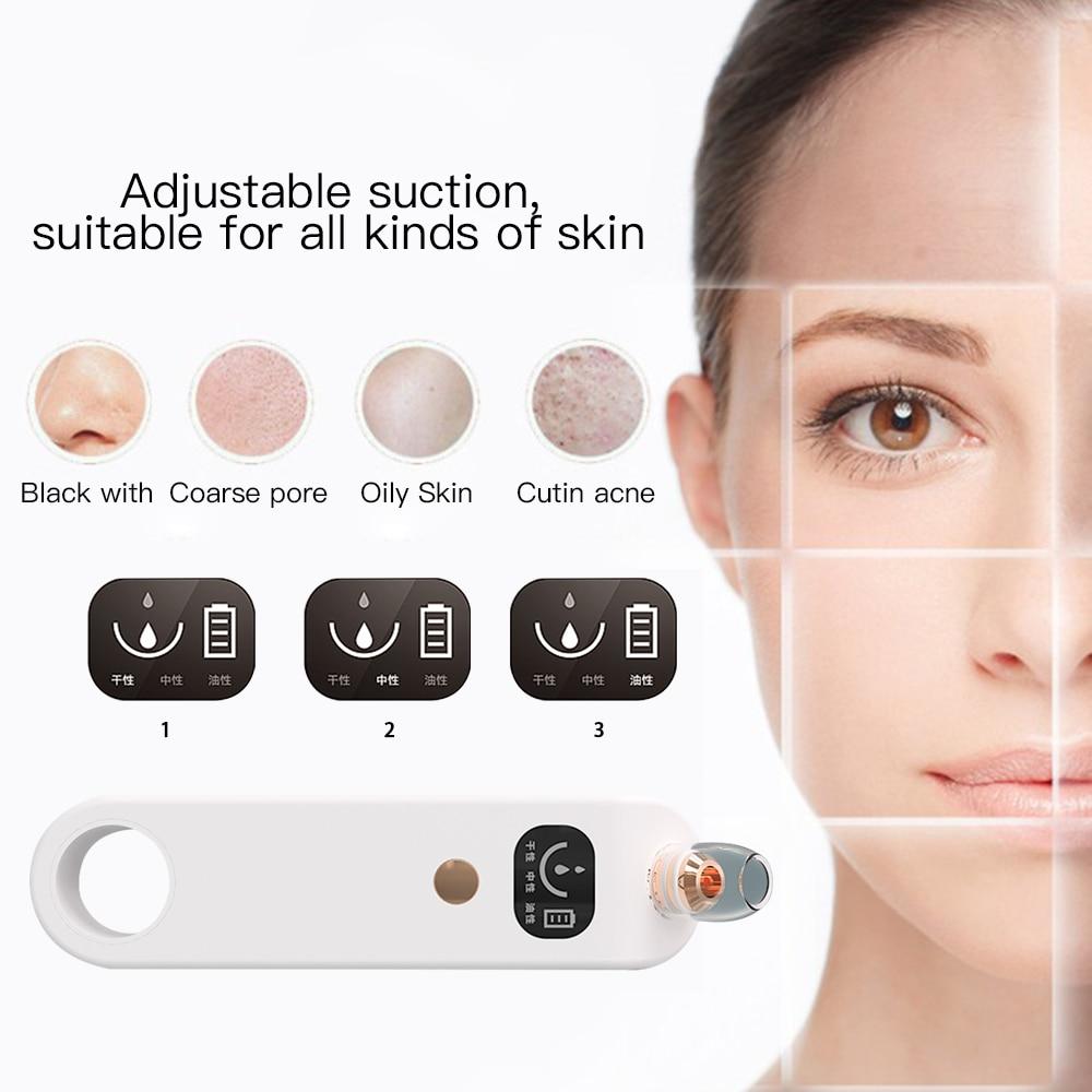 Blackhead Remover Vacuum Cleaner - EZdeels